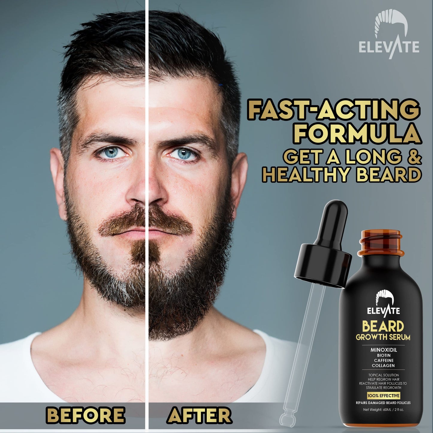 Elevate Beard Growth Oil 5% Minoxidil Hair Growth Serum with Biotin & Caffeine – Grow a Stronger Thicker Fuller Beard Faster – Natural Facial Hair Treatment for Grooming Thickening and Volume 1 Fl Oz